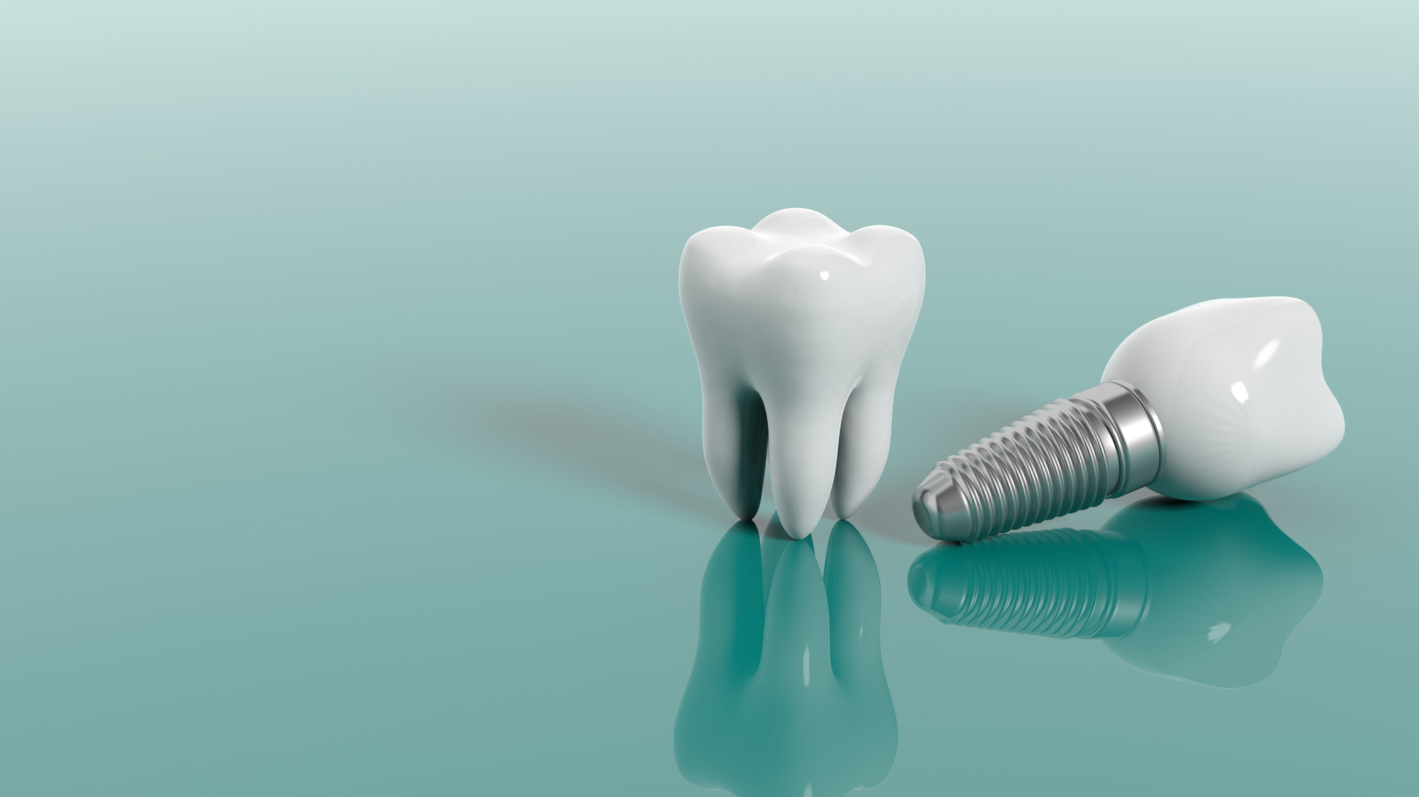 How Can Dental Implants Be Experienced Without Pain?